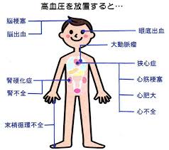 3�x�̃A�����J���w�E�����̊C�O�o�������@�������l�ŕ�炷���җl�ɑ��鑍���f�ÃN���j�b�N